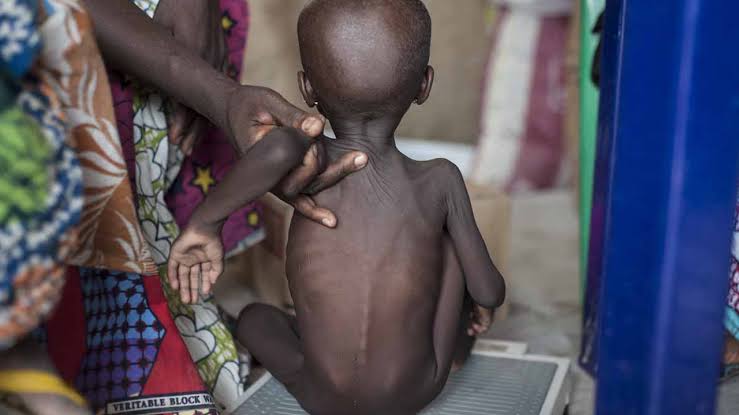 Over 600 Malnourished Children Die in Northern Nigeria – MSF