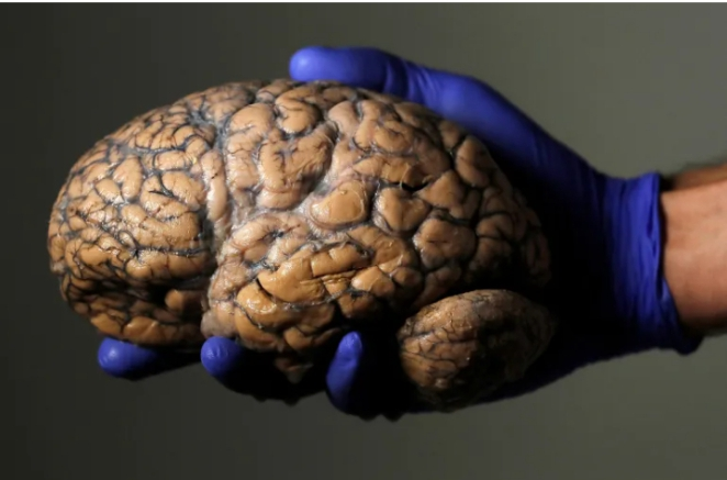 Adolescence lasting until 32: Scientists redefine human brain development