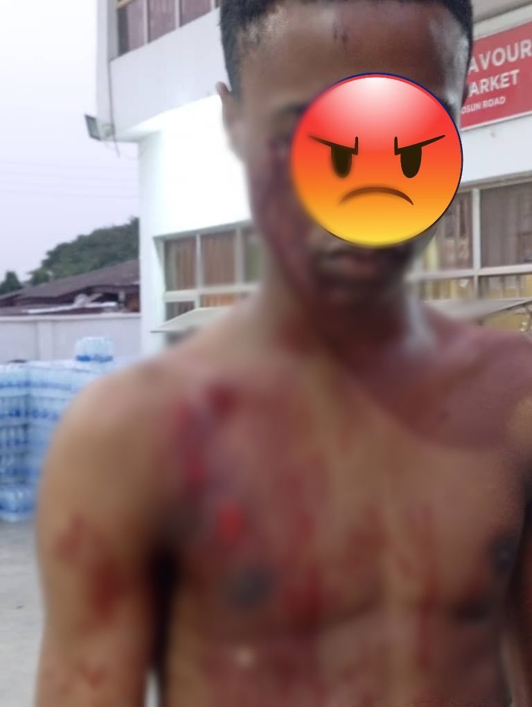Woman stabs 16-year-old teen in Lagos