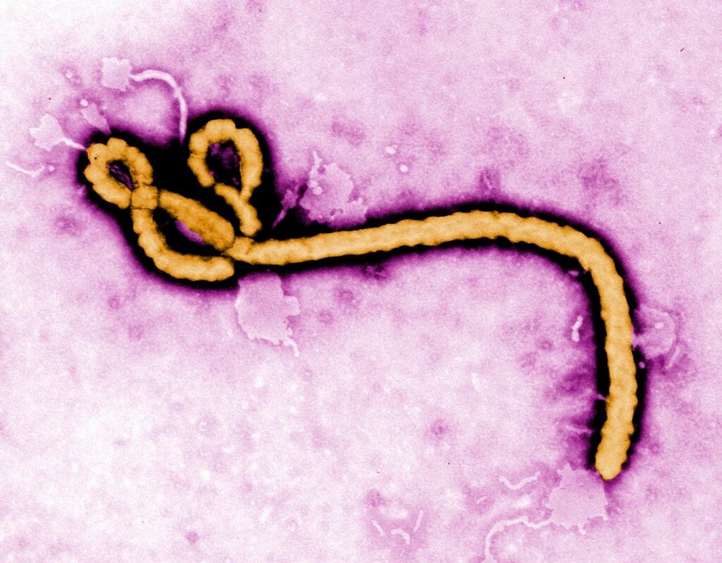 Ebola outbreak in DRC kills 65 amid fears of new virus strain