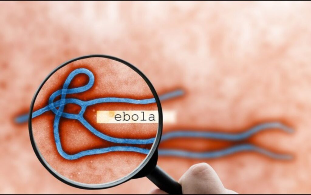 Ebola